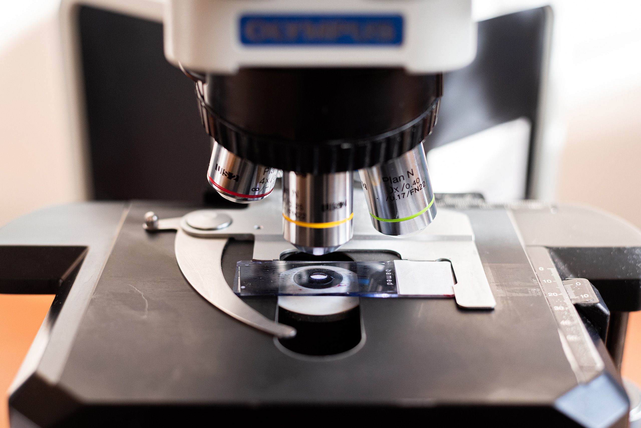 Laboratoř Cytohisto Břeclav Poskytuje komplexní cytologickou diagnostiku  a  histologickou diagnostiku, včetně speciálních histologických a imunohistochemických vyšetření.