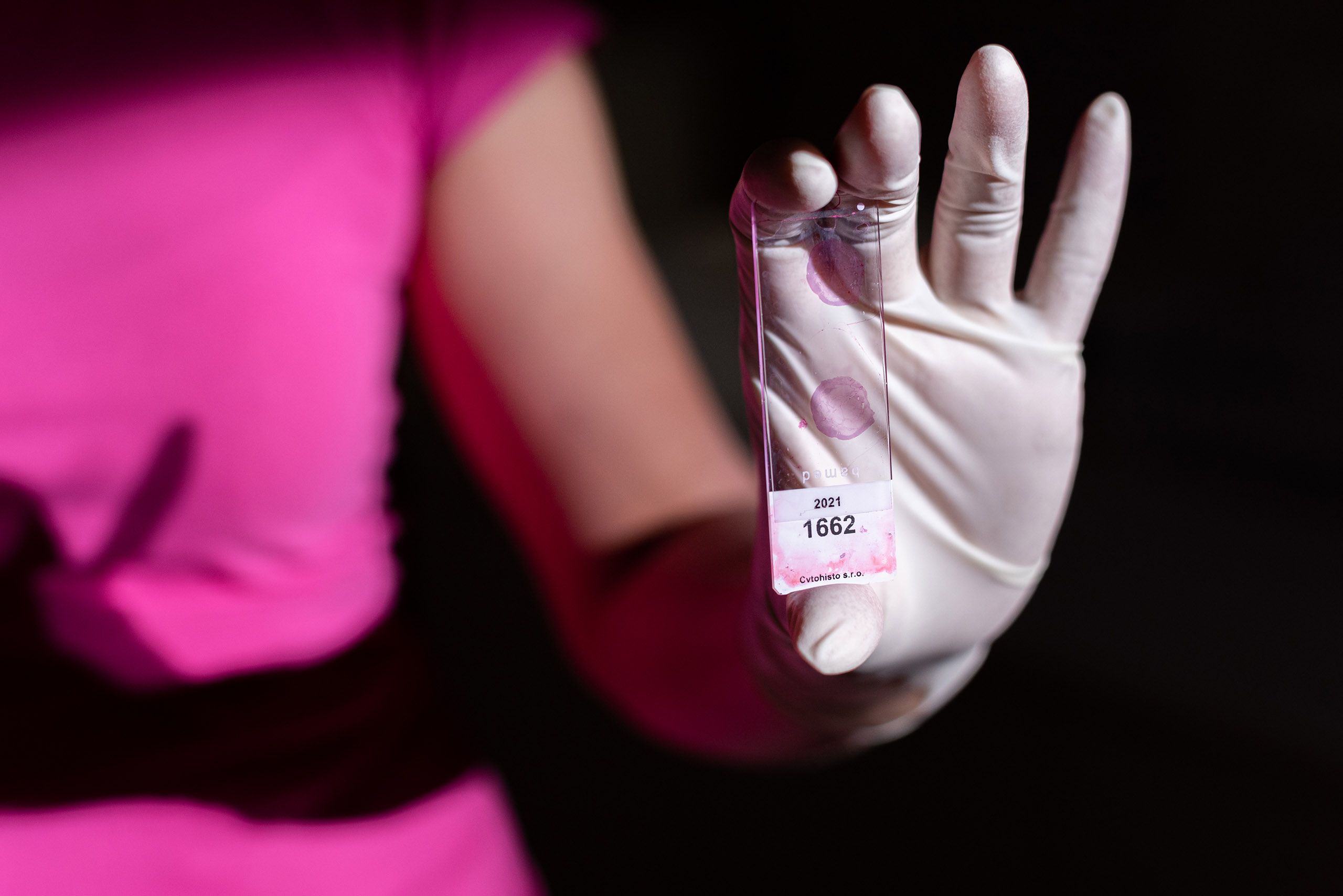 Laboratoř Cytohisto Břeclav Poskytuje komplexní cytologickou diagnostiku  a  histologickou diagnostiku, včetně speciálních histologických a imunohistochemických vyšetření.