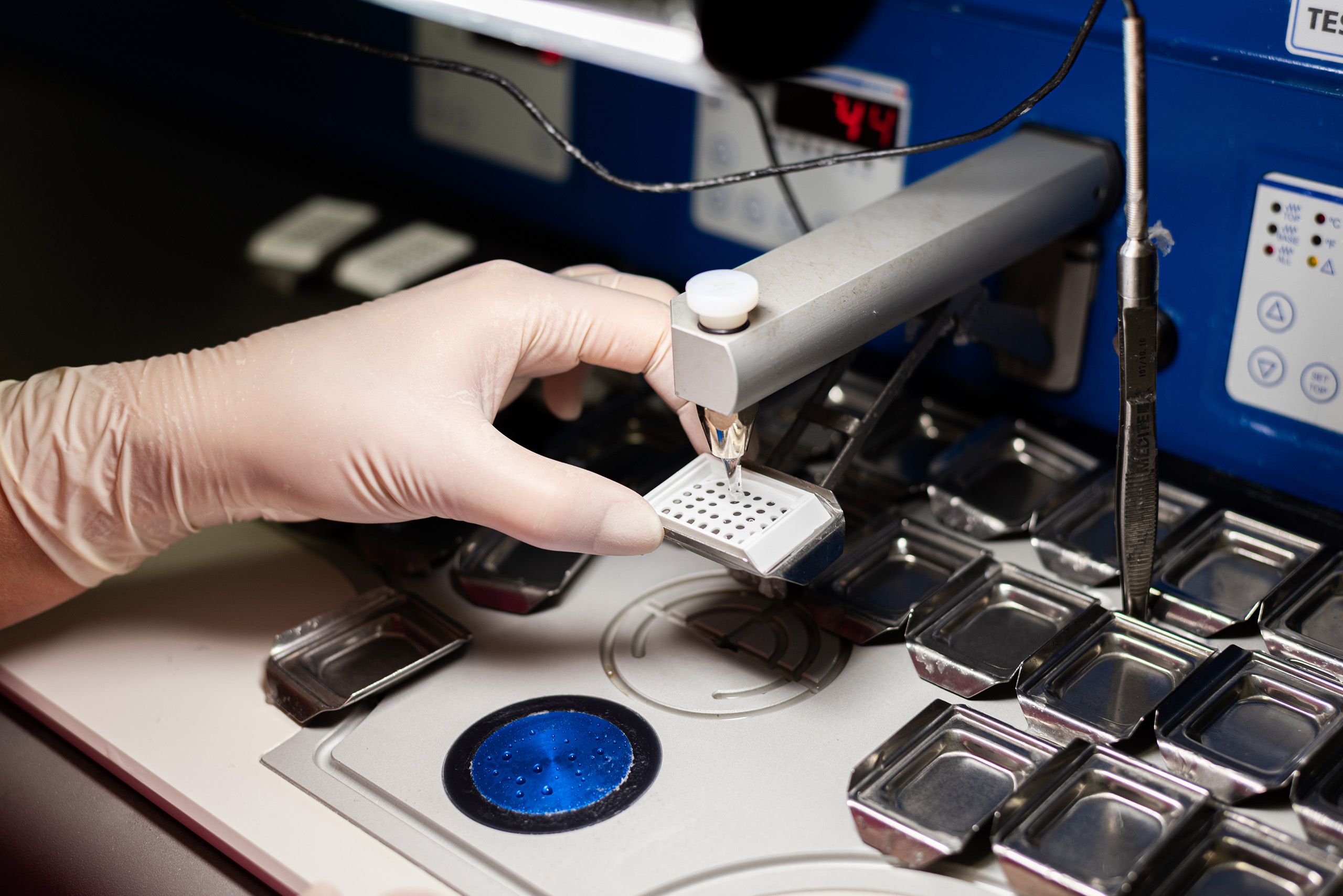 Laboratoř Cytohisto Břeclav Poskytuje komplexní cytologickou diagnostiku  a  histologickou diagnostiku, včetně speciálních histologických a imunohistochemických vyšetření.